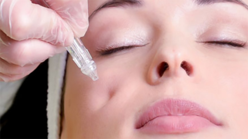 soins-jetpeel soins-jetpeel